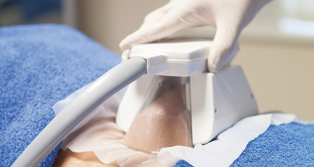 How Fat Freezing and HIFU Work Together? 2 Multiple Areas in One Session HIFU and Fat Freezing Herne Bay