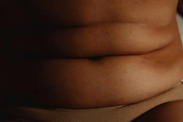 The Hidden Connection: How Stress Shapes Your Fitness and Body Composition 3 image of what stress can do on the stomach area and how Lipo 360 Herne Bay can help to change your body shape.