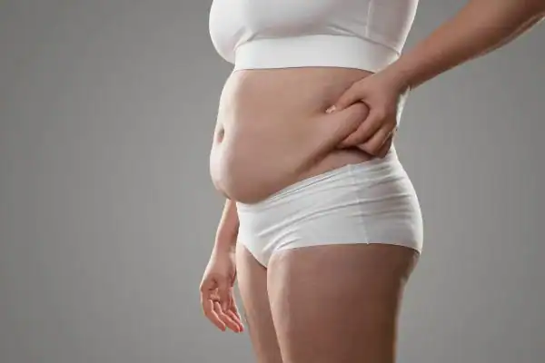 Image of stress belly Herne Bay How Lipo 360 can help manage your symptoms